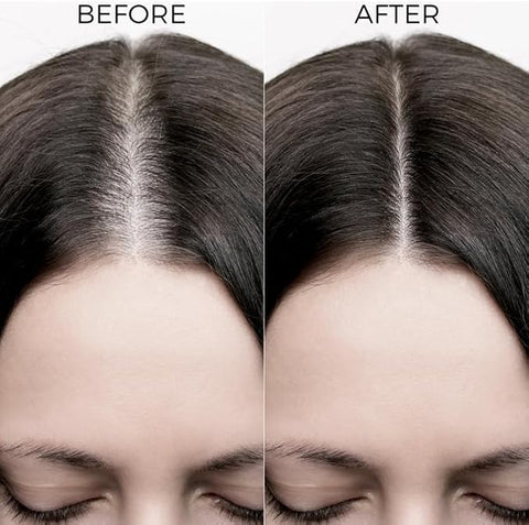 Brillaire Rosemary Oil Shots 6Ml*8 Vials