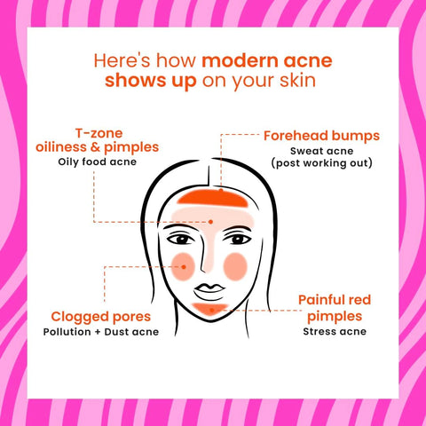 Foxtale True Clarity Oil and Acne Control Face Wash - 100ml