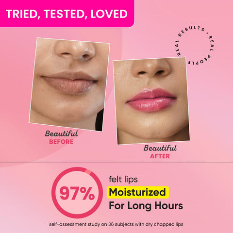 Dot & Key Gloss Boss Lip Balm With Vitamin C+E Watermelon Rush 12gm