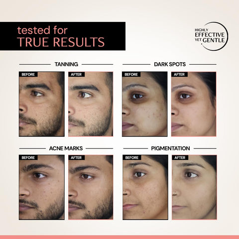 Deconstruct Clearing serum 20ml