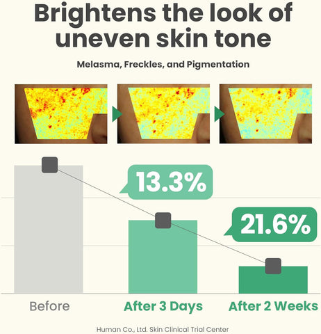 AXIS-Y The Mini Glow Set