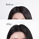 ViveLab Rosemary & Multi-Peptide Hair Growth Serum - Targeted Roll On Scalp Treatment for Thicker Hair Density, Clinically Tested for Healthier Hairline & Brows - Image 2