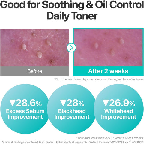 تونر الأعشاب المهدئ بيور-فول من نومبوزين