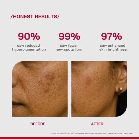 PHD 2% Alpha Arbutin Depigmentation Serum 30ml