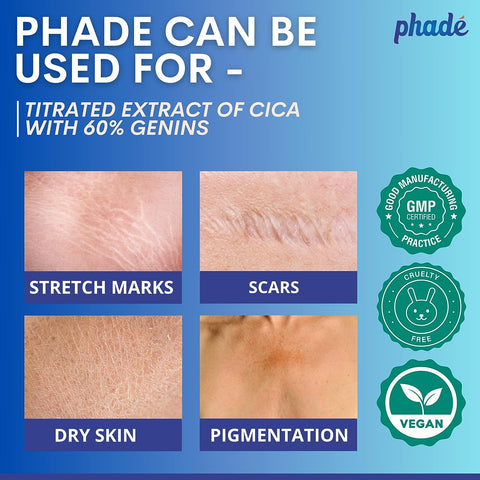 Phade Stretch mark cream 200 ml